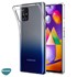 Microsonic Samsung Galaxy M51 Kılıf Transparent Soft Beyaz 5