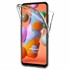 Microsonic Samsung Galaxy M11 Kılıf 6 Tarafı Tam Full Koruma 360 Clear Soft Şeffaf 1